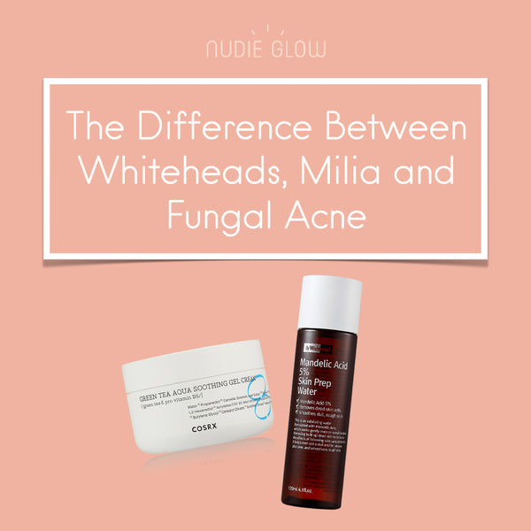 What's the Difference Between Whiteheads, Milia and Fungal Acne ...