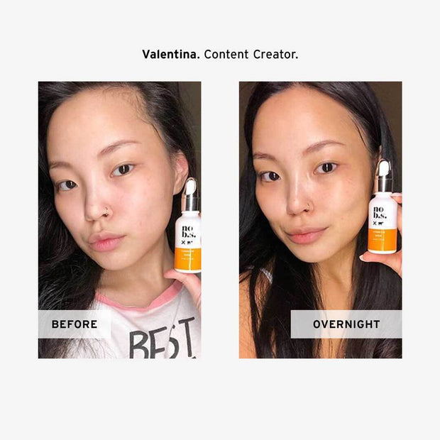 vitamin c serum before and after