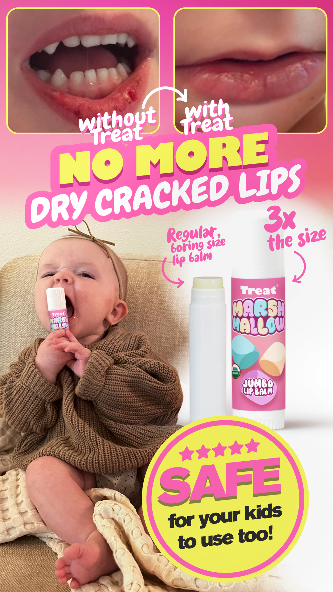 Kids love this lip balm - Marshmallow Jumbo Lip Balm