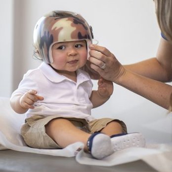 Baby with helmet to reshape the skull