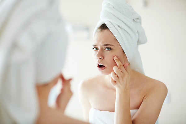 Acne Scars: Avoid, Abate, Abolish