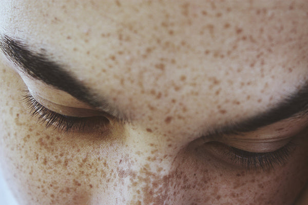 Dear Freckled Beauties