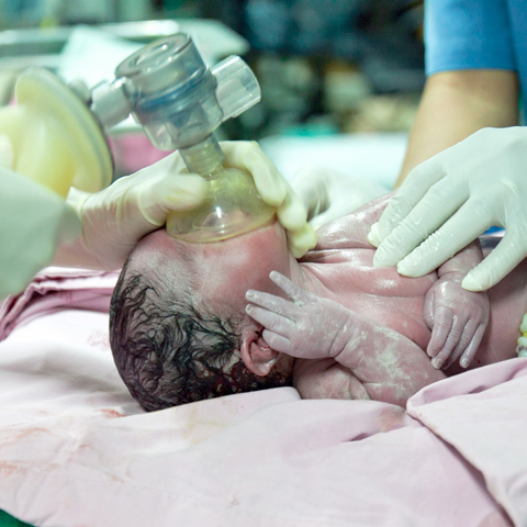 Delayed Cord Clamping