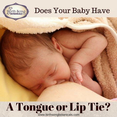 Breastfeeding with a Lip or tongue tie