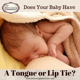 Breastfeeding a baby with a tongue or lip tie