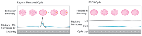 regular cycle vs PCOS cycle