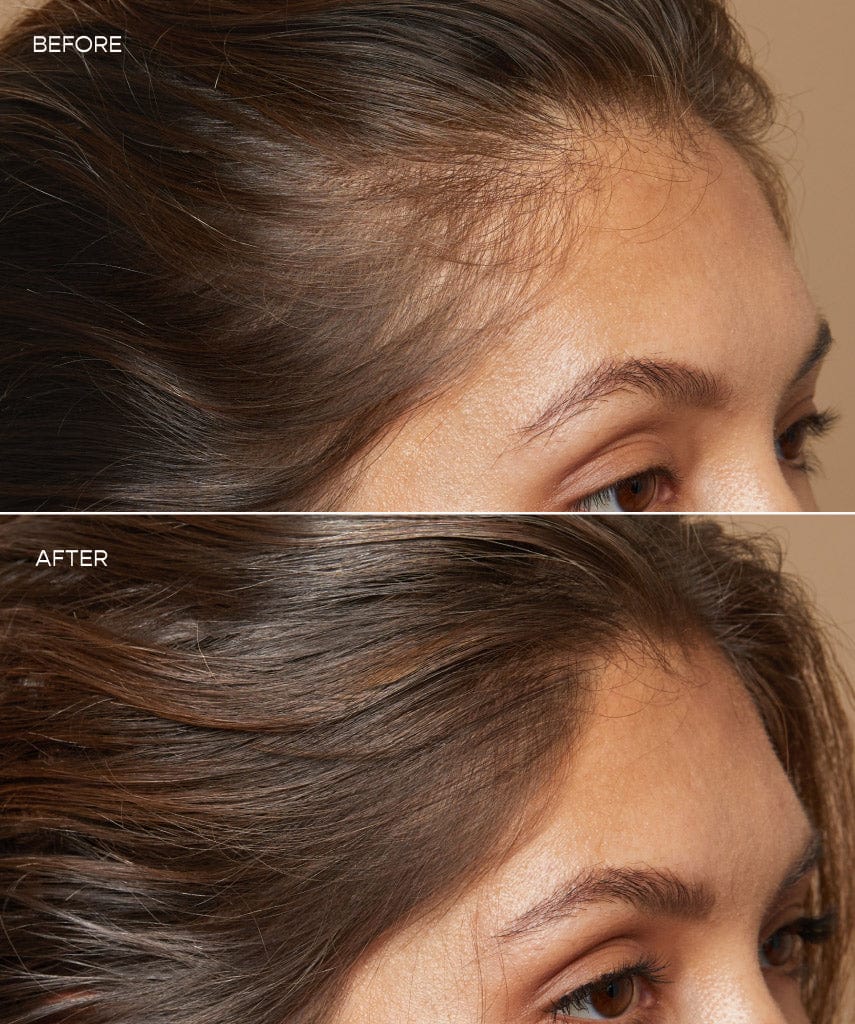 GRO Hair Serum - Before & After