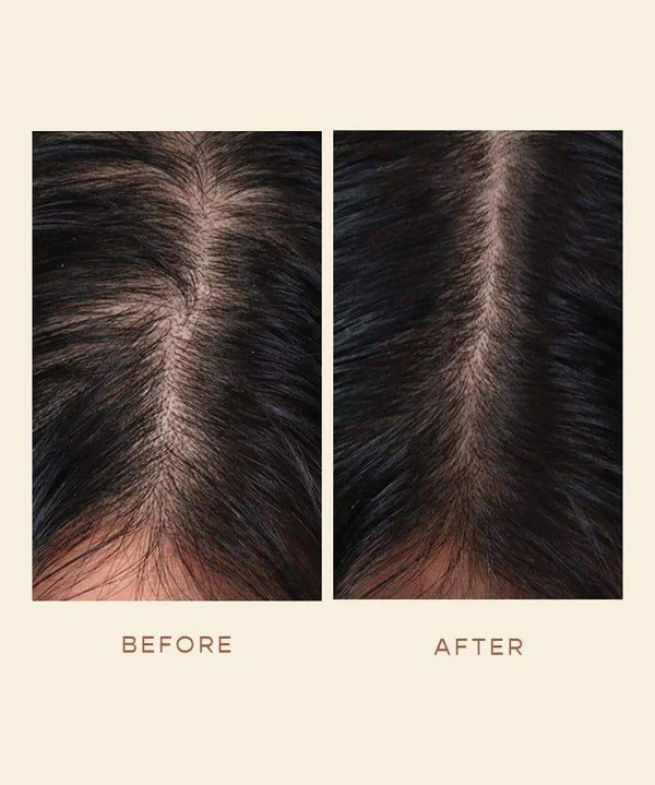 GRO Hair Serum Before & After