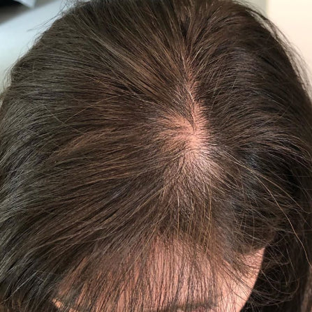 GRO Hair Serum - Thicker Looking Hair In As Soon As 90 Days