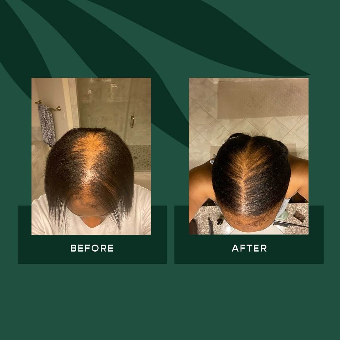 VEGAMOUR GRO Hair Serum Before & After