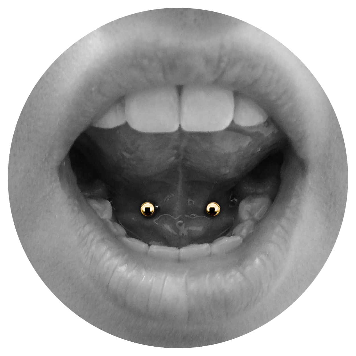 Oral_TongueWebbing