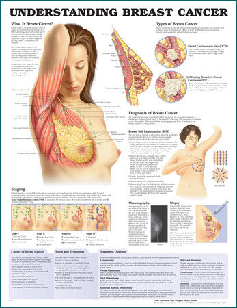 Breast Cancer, Signs, Symptoms, Stages, Treatment, About Risk