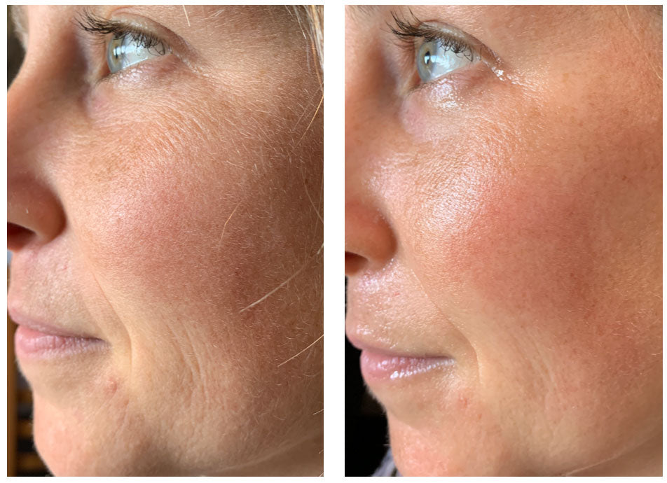 Before / After results showing reduced appearance of fine lines under eye, improved skin texture, and increased moisture 