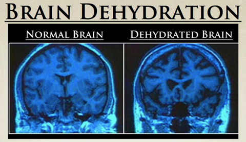 5 Slightly Effects of Dehydration