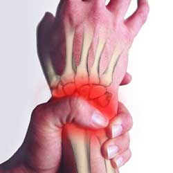 Wrist pain, repetitive strain and overuse wrist injury