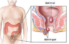 các bệnh lí về đường ruột