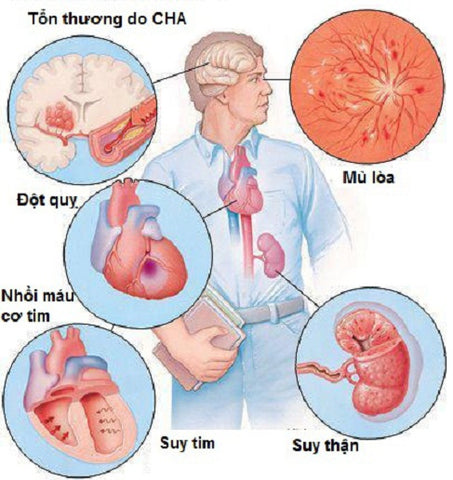 biến chứng khi tăng huyết áp