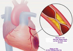 dùng steroid ảnh hưởng đến tim mạch