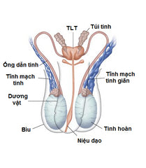 giãn tĩnh mạch tinh tuổi thiếu niên