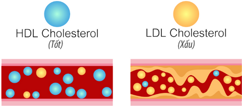 tập luyện cholesterol 