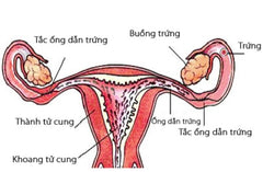 vấn đề buồng trứng gây hiếm muộn