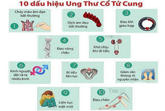 dấu hiệu ung thư cổ tử cung