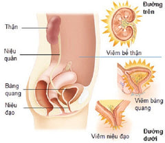 viêm đường tiết niệu khi mang thai