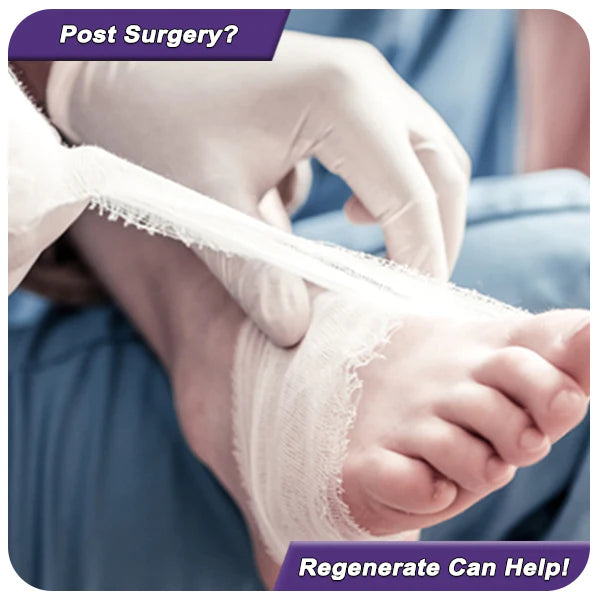 Regenerate + BPC157 For Post Surgery Injuries