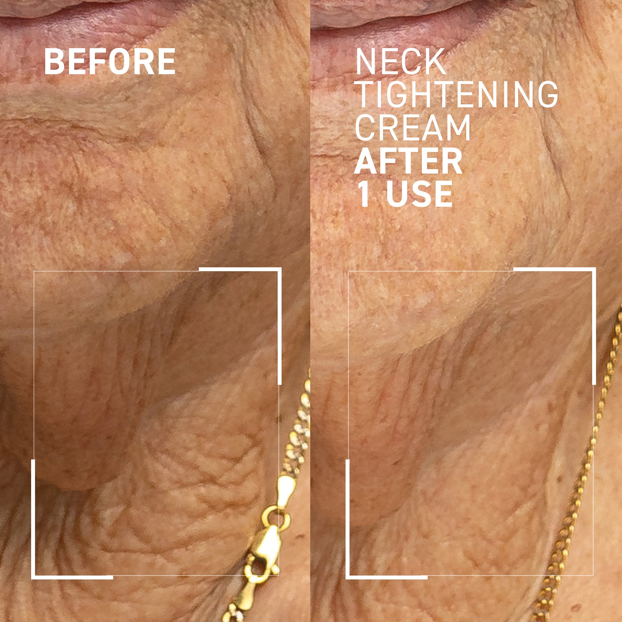  Dr. Brandt Needles No More Wrinkle Smoothing Cream