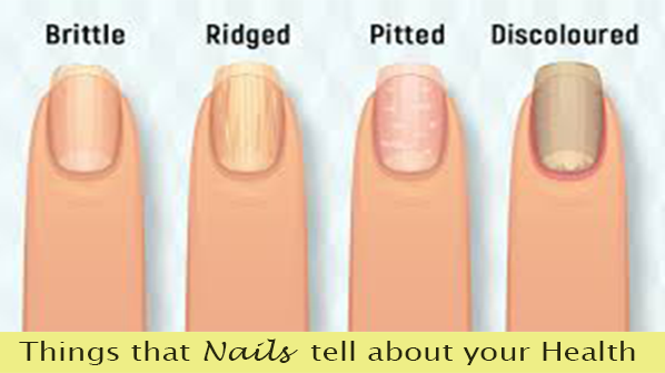 Nail disorders