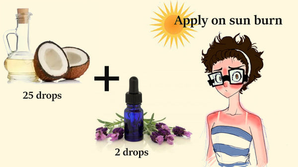 lavender oil to heal sun burn