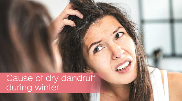 get rid of dandruff in winter
