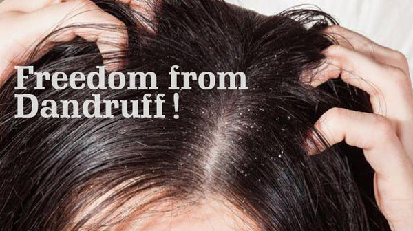 treat dandruff naturally