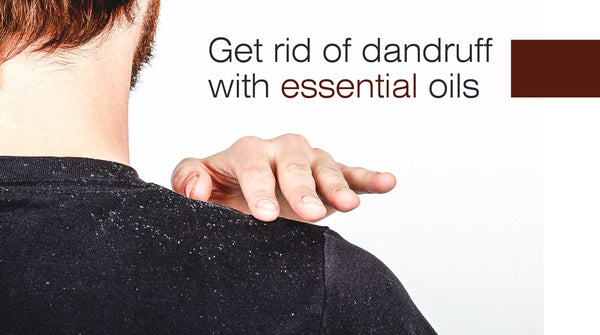 get rid of dandruff in winter