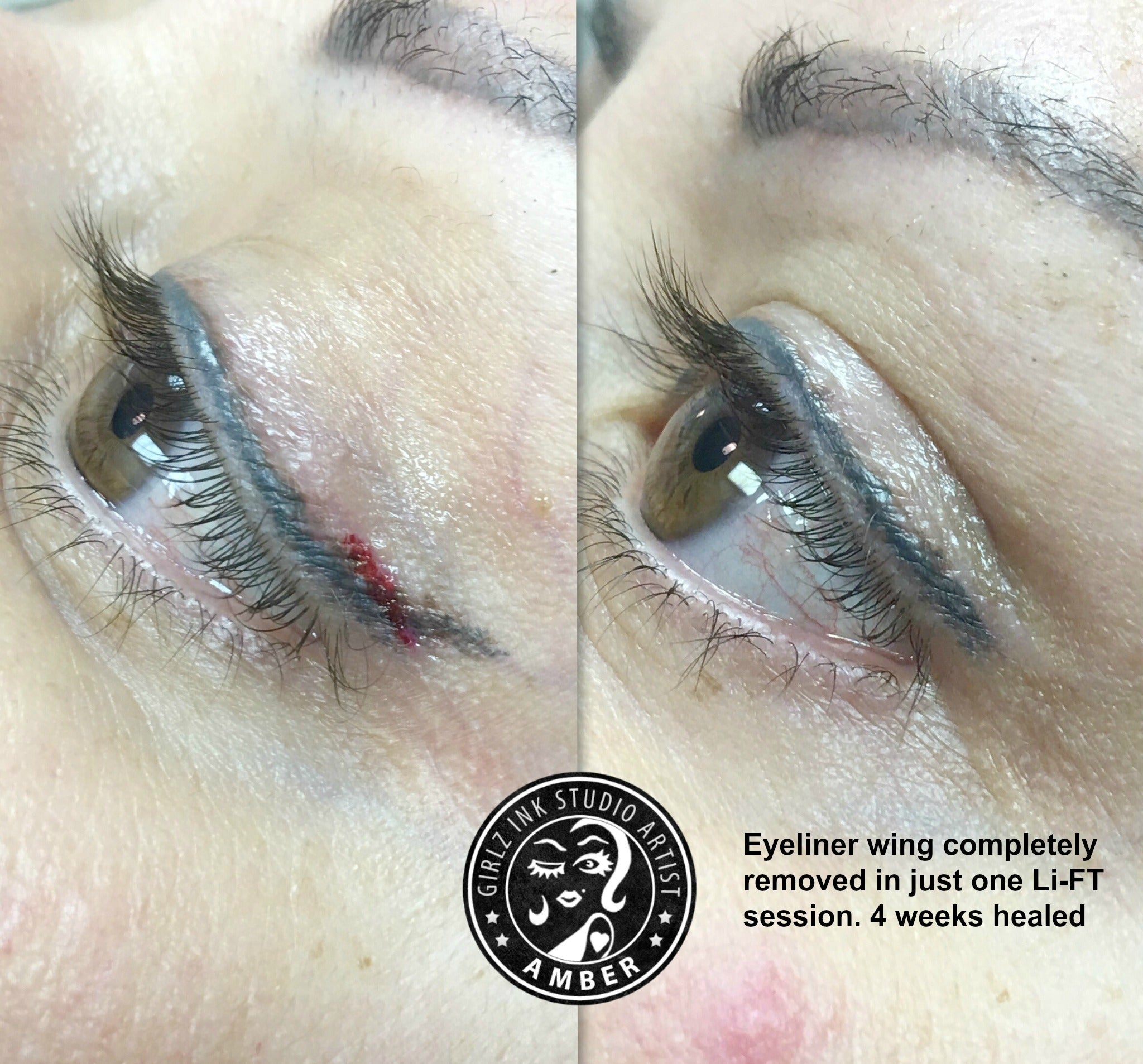 Lift Pigment Lightening  Removal  Just Brows Inc