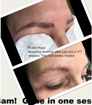 Lift Pigment Lightening  Removal  Just Brows Inc