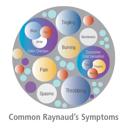 Common Raynaud's Symptoms
