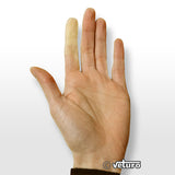 Raynaud's symptoms white fingers due to stress