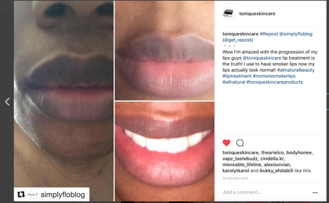 before and after of lip lightening
