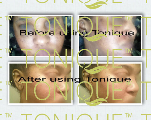 Tonique customer before and after