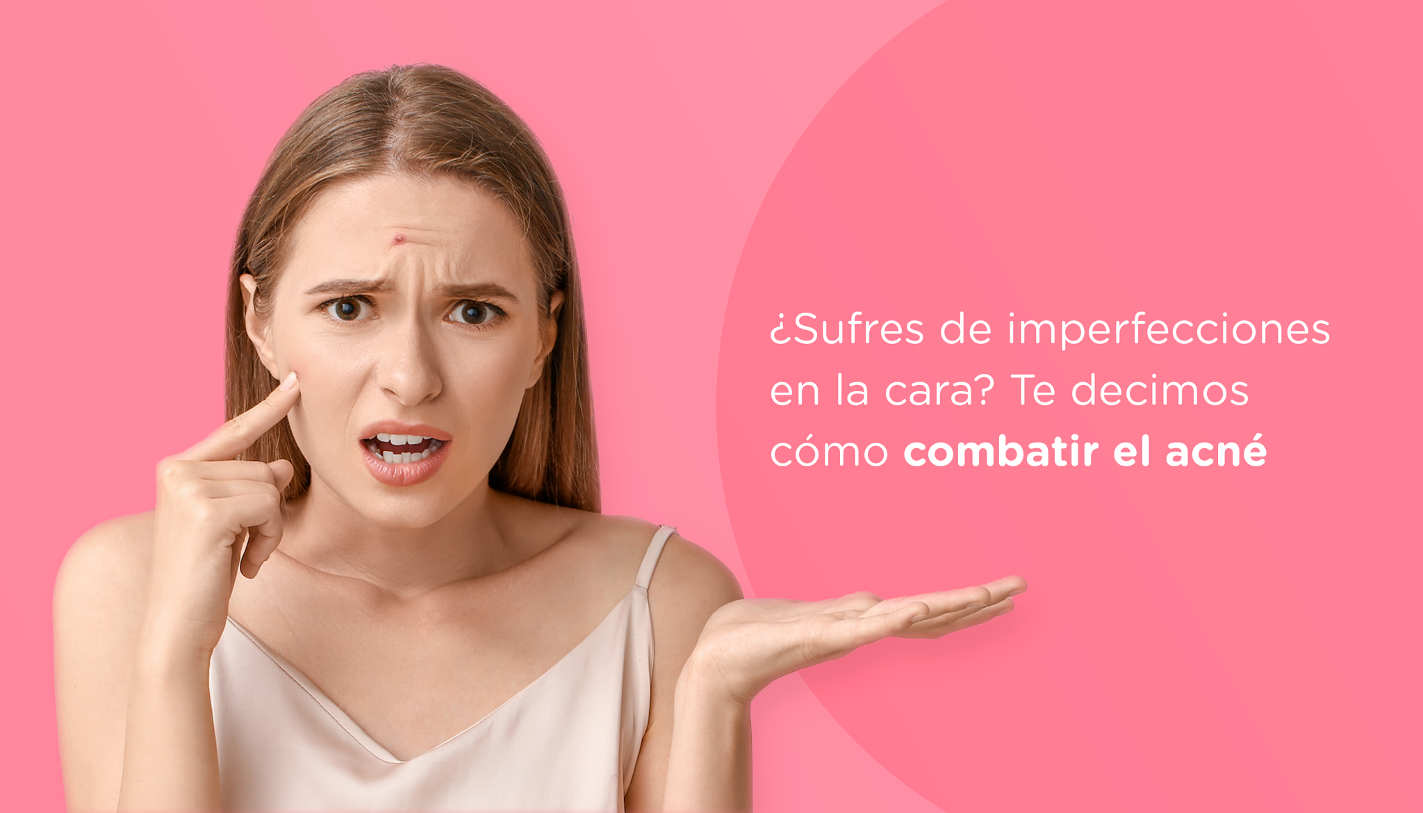 PORTADA - ¿Sufres de imperfecciones en la cara? Te decimos cómo combatir el acné