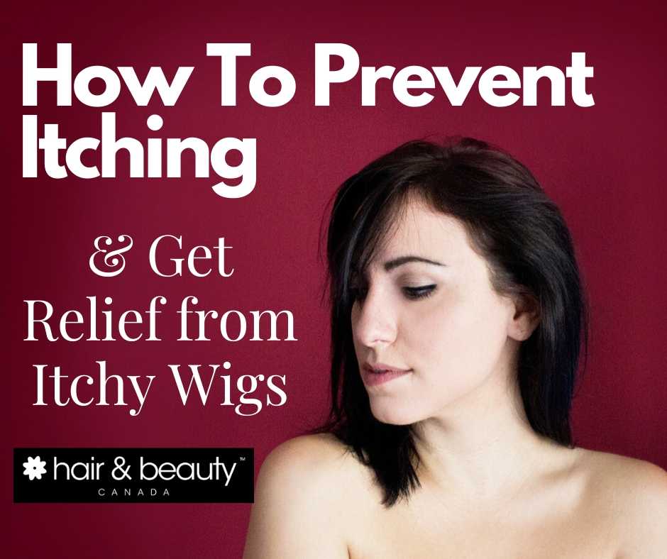 relief from itchy wigs