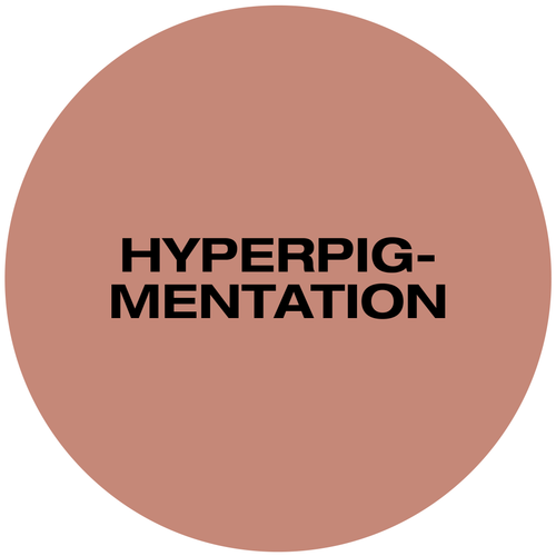 Hyperpigmentation