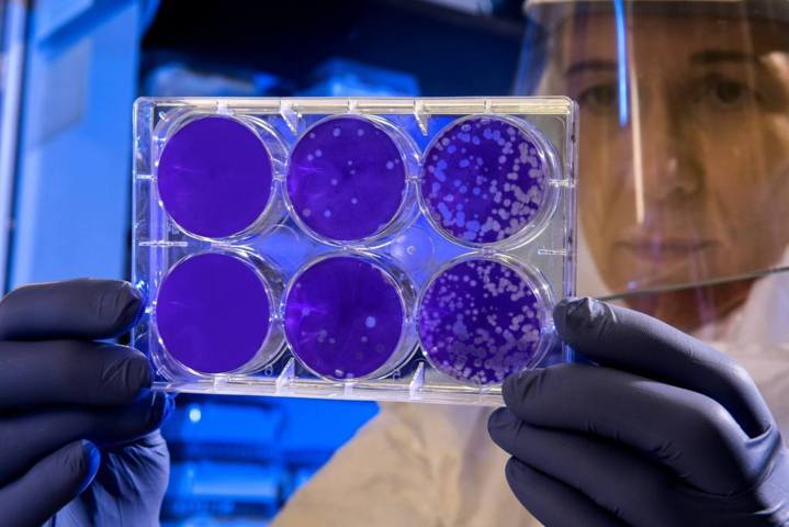 woman wearing personal protective gear holding Petri dishes of bacterial culture