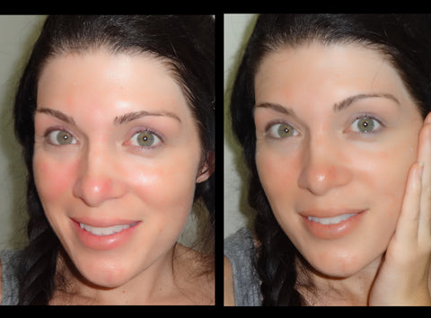 Pure Heals from Blue Scandal Before and After