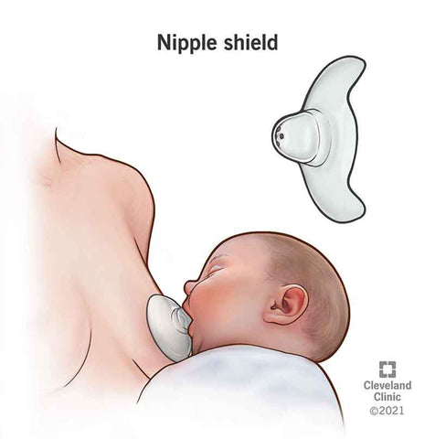 Breastfeeding Your Premature Baby with a Nipple Shield : Breastfeeding  Journey