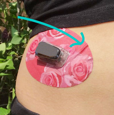 Avoid lifts in your tape to keep your Dexcom adhesive tape on longer 