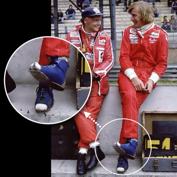 James Hunt with the toes cut out of his racing boots