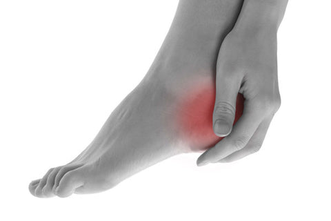 Two Places Where Heel Spurs Can Form - Blog