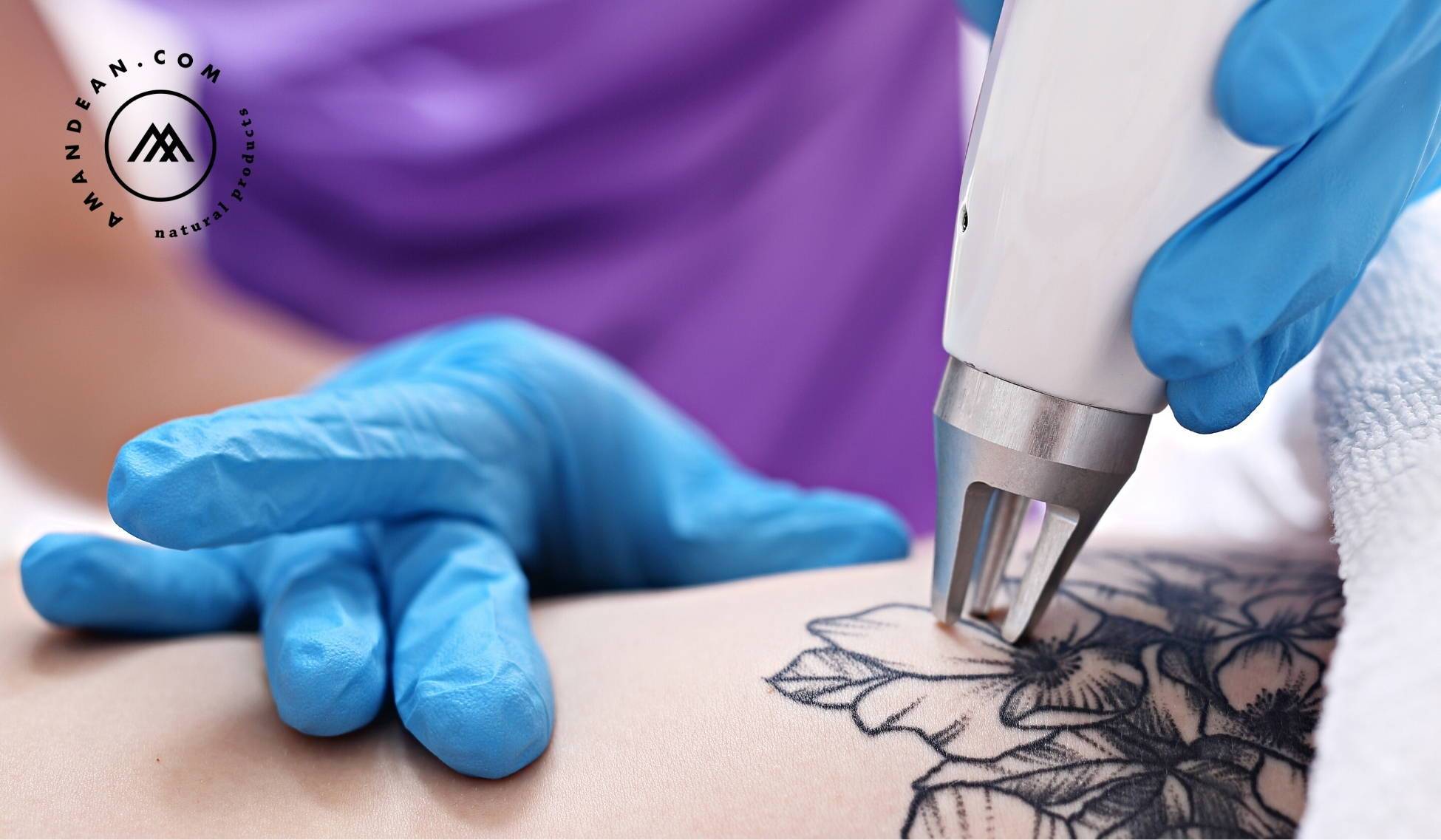 Tattoo Removal Aftercare  YouTube